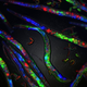 Adult C. elegans worms with embryos inside them. Image: Adam Klosin, CRG.